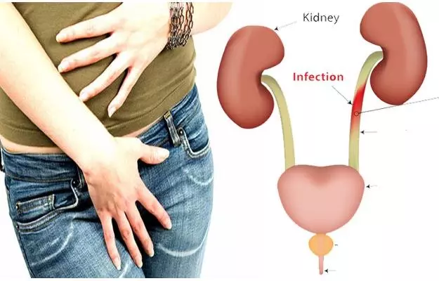बारम्बार पिसाब लाग्नु: शरीरको संकेत हो या गहिरो समस्या? एक विस्तृत विश्लेषण